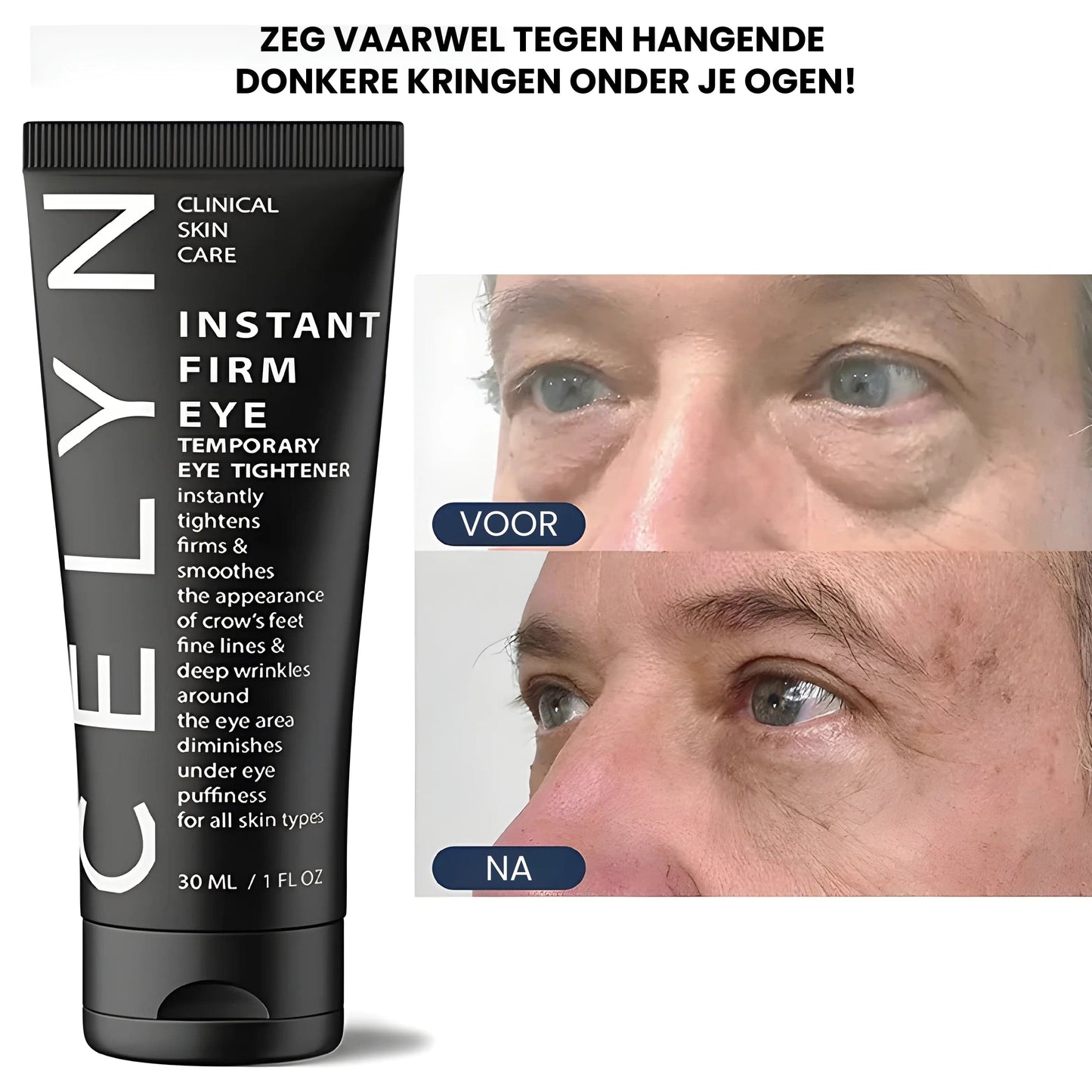 Luna Milis 2x Cëlyn™ Anti-Wallen Crème (1+1 GRATIS) Cëlyn™ Anti-Wallen Crème | Verwijder wallen en dokere kringen in 3 minuten!